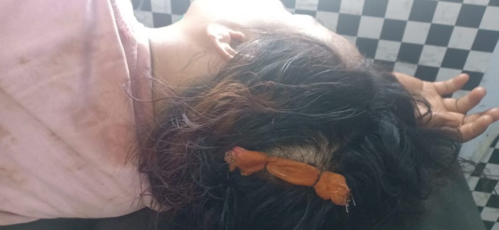 Seorang Ibu Rumah Tangga di Bima Dianiaya Karena Memukul Istri Pelaku.