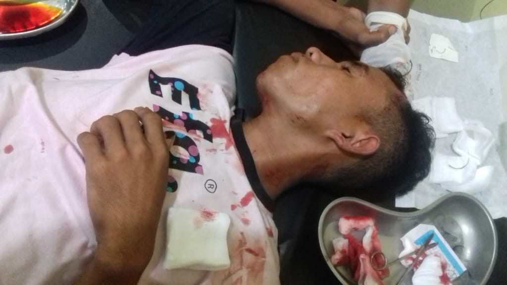 Dua Desa di Dompu Terlibat Perkelahian, Dua Orang Alami Luka Robek di Kepala.