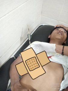 Seorang Pria di Dompu Dipanah Orang Tidak Dikenal.