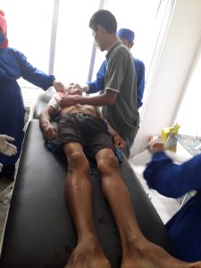 Ingin Bungkus Buah Nangka Seorang Pria di Dompu Malah Kesetrum Listrik dan Meninggal