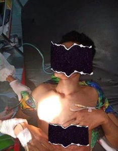 Seorang Pelajar Asal Sumbawa Barat Ditikam Hingga Tewas. Diduga Gara-gara Berebut Pacar.