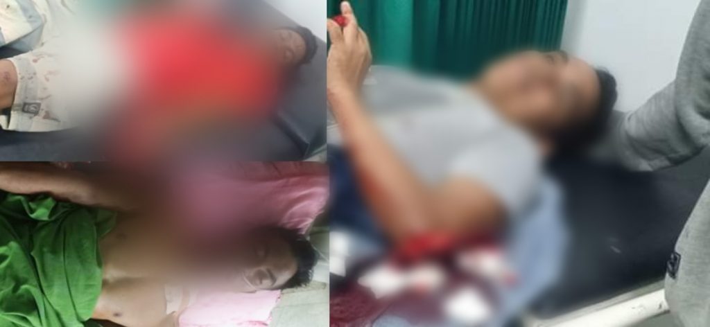 Karena Cekcok Mulut Tiga Pria di Dompu Saling Bacok Hingga Luka Parah