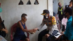 Kapolres Sumbawa Akan Rujuk Nurdin, Penderita Tumor Mata Ke Mataram