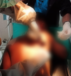 Dua Pelajar di Dompu Dibacok dan Dipanah Oleh Orang Tidak Dikenal