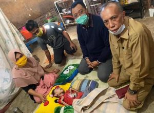 Dapat Info Dari Medsos, Gubernur NTB Kunjungi Bocah Pengidap Sindrom Selaput Otak di Bima