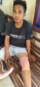 Tim PUMA Polres Dompu bekuk Pelaku Penganiayaan