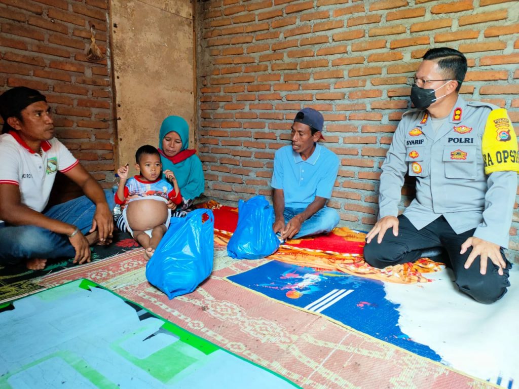 Sense of Crisis, Kapolres Dompu Kunjungi dan Santuni bocah penderita Hirsprung
