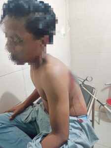 Pemanahan misterius kembali beraksi, remaja 15 tahun jadi korban