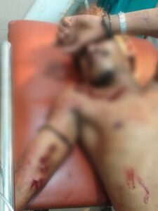 Niat Melerai Penganiayaan Sejumlah Buruh Pasar di Dompu, Pria Paruh Baya Ini Malah Kena Bacok