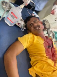 Gegara Dimarahi Ibunya Pria di Sumbawa Barat Bacok Korbannya