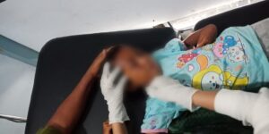Naas, Bocah 5 Tahun di Dompu Diserang Anjing Rabies, Polisi Identifikasi
