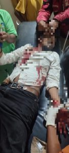 Gegara Mengejar Anak Tirinya, Pria di Dompu Dibacok Keluarga Dari Mantan Suami Istrinya