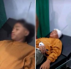 Viral Siswa SMP Asal Renda Dompu Dipanah di Bagian Kepala, Pelaku Kabarnya Telah Diamankan
