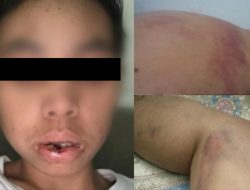 TKW Asal Sumbawa Diduga Dianiaya di Libya, Gaji Ditahan dan HP Dirusak Majikan: Ini Permintaan Keluarga