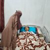 Kisah Pilu Remaja 18 Tahun Asal KSB yang Diduga Idap Autoimun: Berat Badan Turun Jadi 20 Kg, Keluarga Minta Uluran Tangan