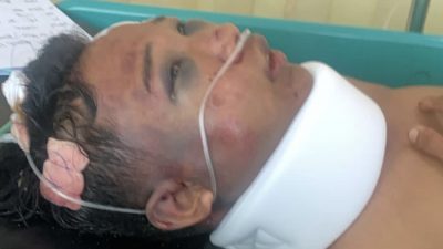 Logikanya Aneh Kematian VR di Nipah, Dipukul dari Belakang Hingga Babak Belur Kok Jadi Tersangka?