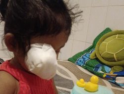 Kabar Bahagia dari Bali, Tumor Mata Karina Zauharatul Kini Mengecil: Orang Tua Ungkap Rasa Syukur dan Harapan Baru
