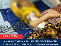 Anak 4,5 Tahun Asal Selengen Derita Gizi Buruk Berat, Dinkes KLU Temukan Riwayat Penyakit Kronis dan Nol Imunisasi