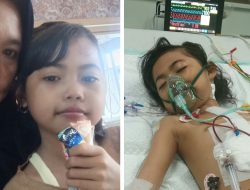 Harapan untuk Adira: Bocah Sumbawa Usai Operasi Katup Jantung di RS Sanglah, Keluarga Petani Butuh Uluran Tangan