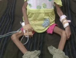 Anak 3 Tahun di Bima Alami Gizi Buruk, Berat Badan Hanya 5 Kg, NTBCARE Desak pemda dan Pemprov NTB Bergerak Cepat
