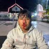 PMII Lombok Barat Kecam Dugaan Tindakan Represif Aparat, Ketua Cabang Terluka Hingga Berdarah