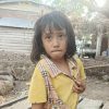 Ayo Bantu Nur Rizkia Ajahra, Bocah 6 Tahun Asal Dompu Berjuang Melawan Kelumpuhan dan Luka Menganga di Pantat