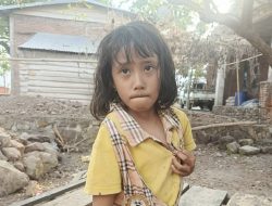 Ayo Bantu Nur Rizkia Ajahra, Bocah 6 Tahun Asal Dompu Berjuang Melawan Kelumpuhan dan Luka Menganga di Pantat