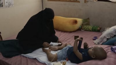 NTBCare Bantu Perjuangan Karina Lawan Kanker Mata di Bali, Pemda KSB Diminta Bantu Biaya Rp33,7 Juta